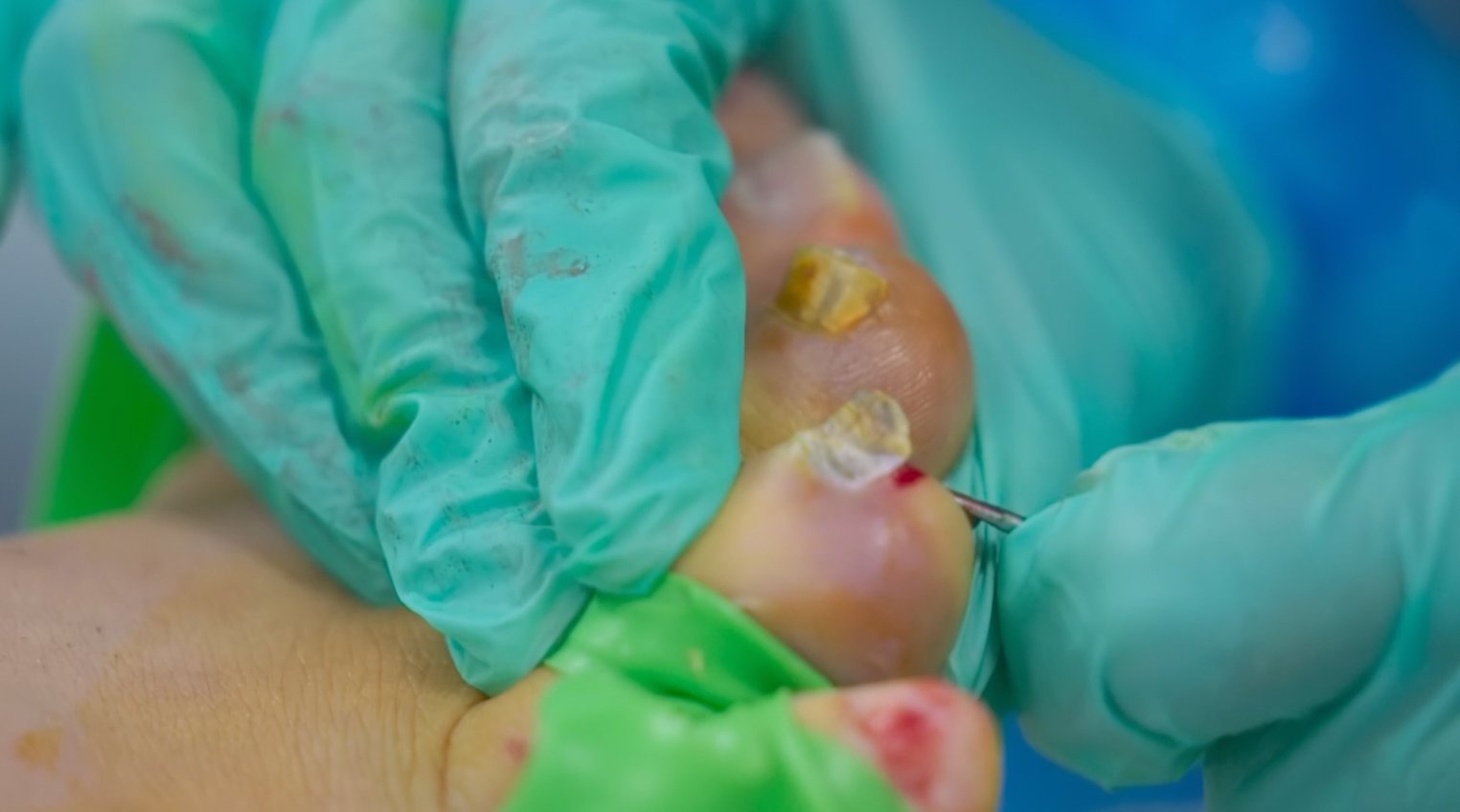The Bad Foot Clinic